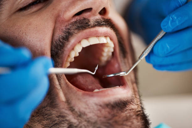 Best Emergency Dental Extractions in Dravosburg, PA